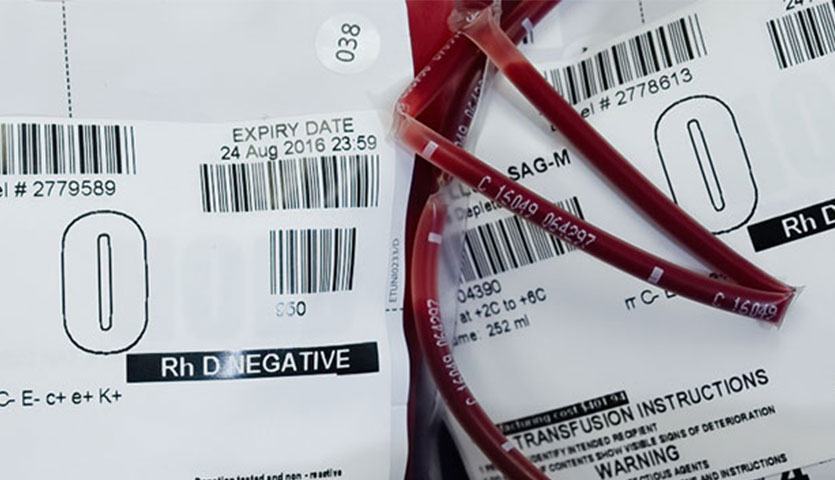 blood packs labelled o negative