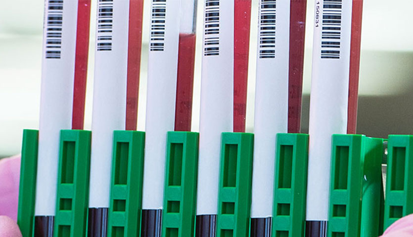 several test tubes of blood are in a holder