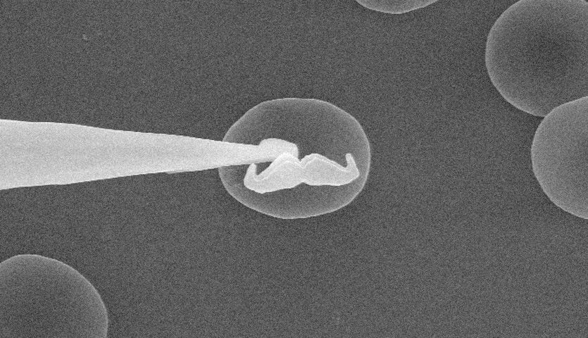 black and white photograph of a moustache being placed on a blood cell taken with an electron microscope