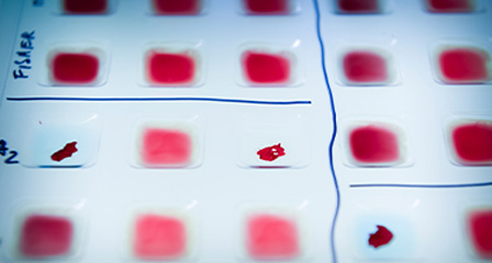 close up of a series of blood samples