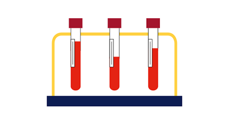 illustration of three test tubes containing blood