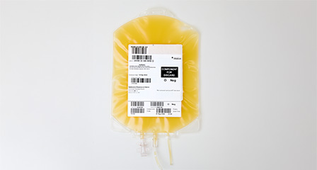 a bag containing yellow apheresis platelets with a label on the front