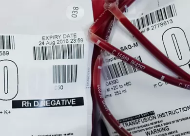 blood packs labelled o negative