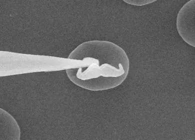 black and white photograph of a moustache being placed on a blood cell taken with an electron microscope