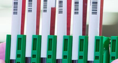 several test tubes of blood are in a holder