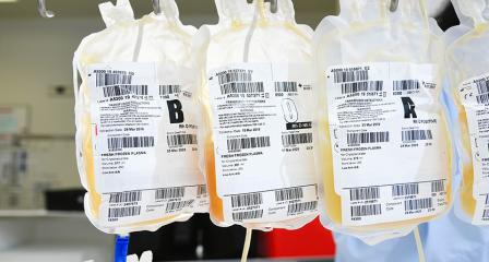 three bags of plasma hanging in a row