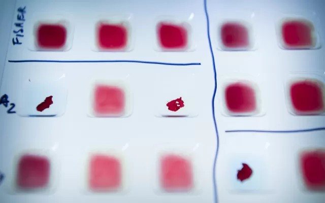 Blood typing