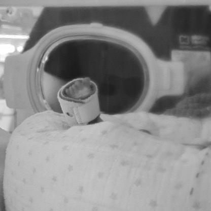 premature baby foot in hospital