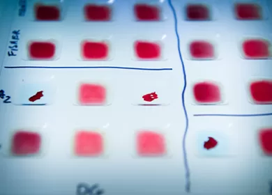 close up of a series of blood samples